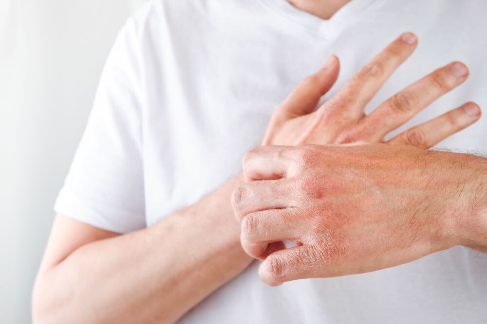 Раздражение и сухость кожи