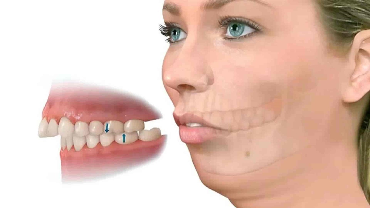 Стоматология Премоляр