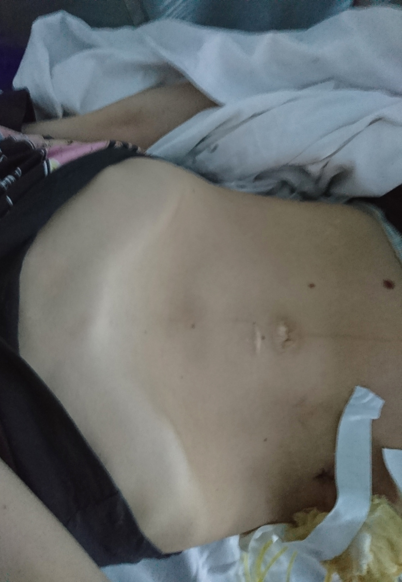 Впадина под грудиной