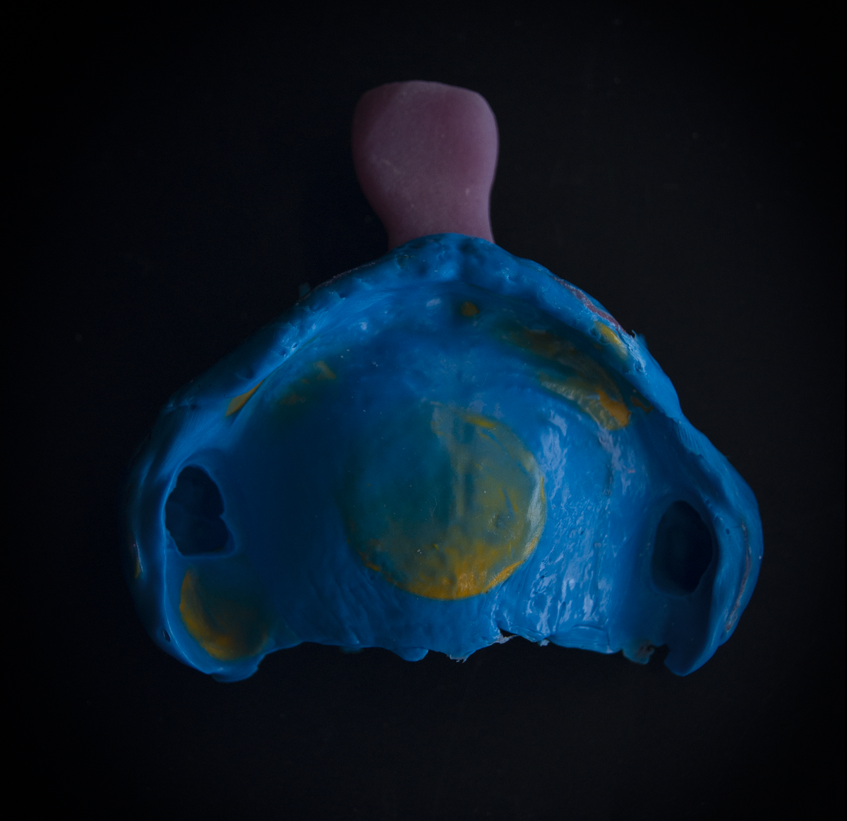 Слепок полости рта пациента выполненный индивидуальной ложкой, верхняя челюсть.