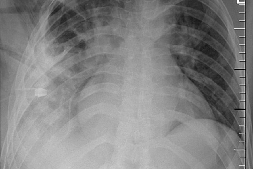    Фото: Journal of Surgical Case Reports