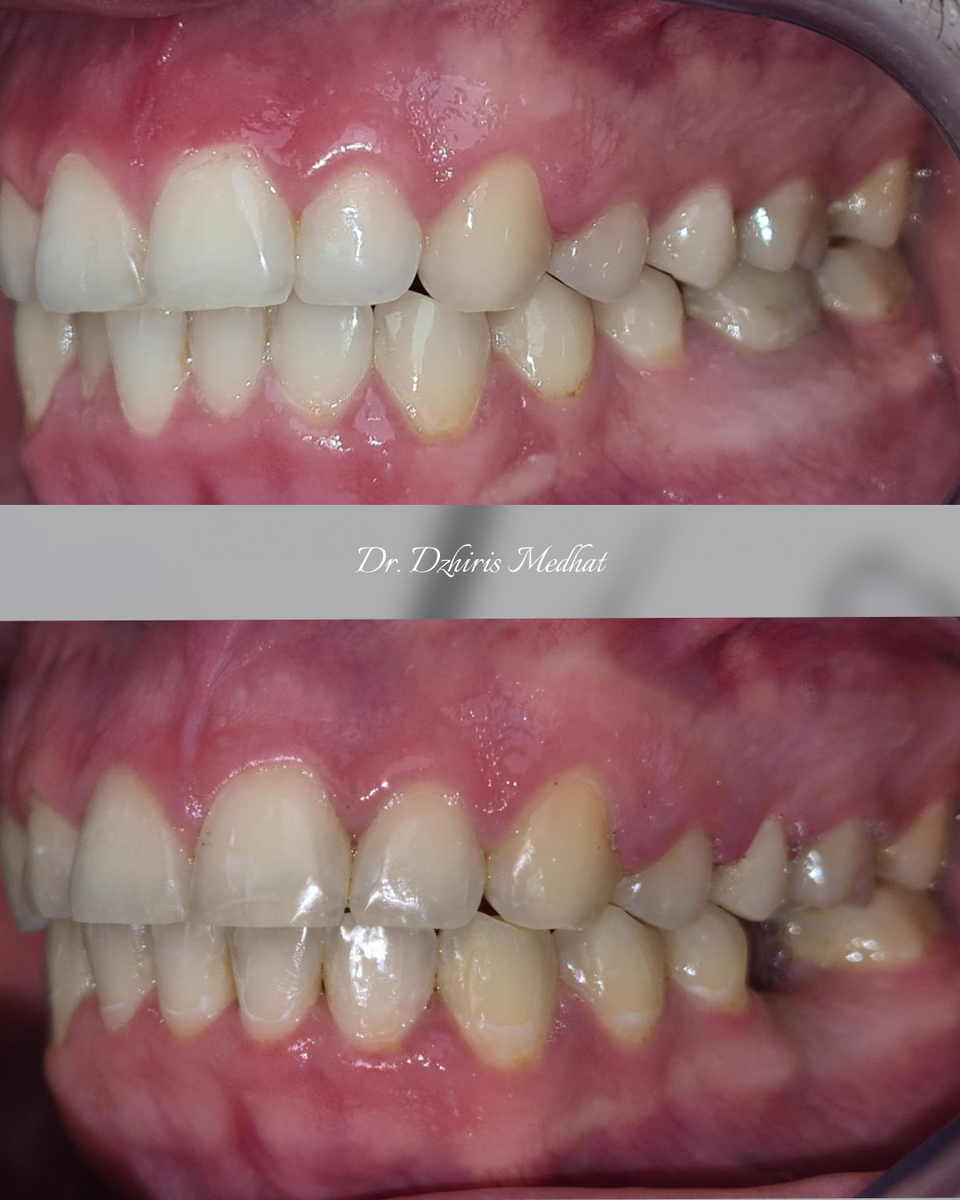 Несколько фото с клиническим случаем до и после лечения