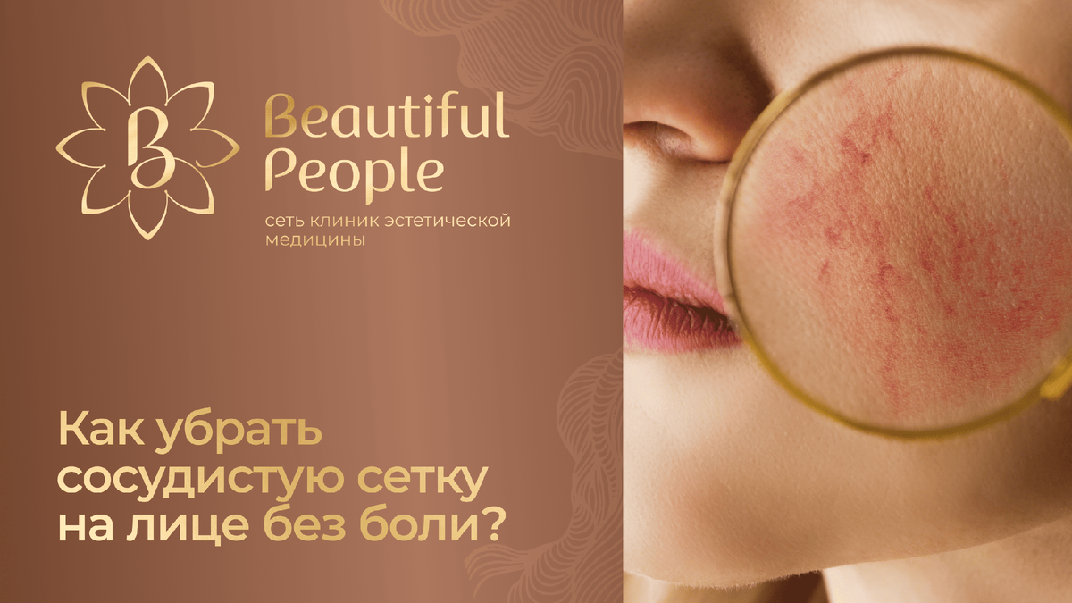Как убрать сосудистую сеточку на лице? Есть способы сделать это без боли!