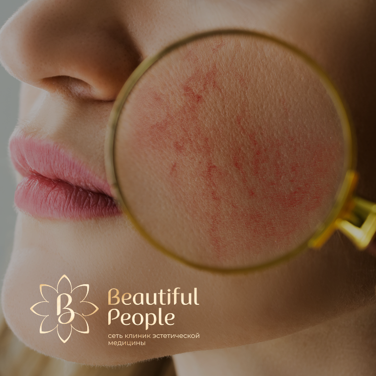 Сосудистая сеточка - есть решение!