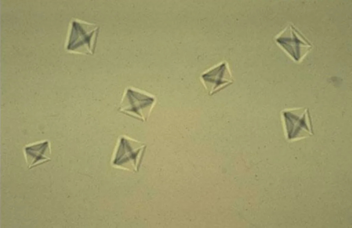 Оксалат кальция под микроскопом.