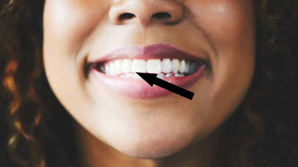    Уникальный Кератин из овечьей шерсти восстанавливает зубы Впервыепрорыв в стоматологии