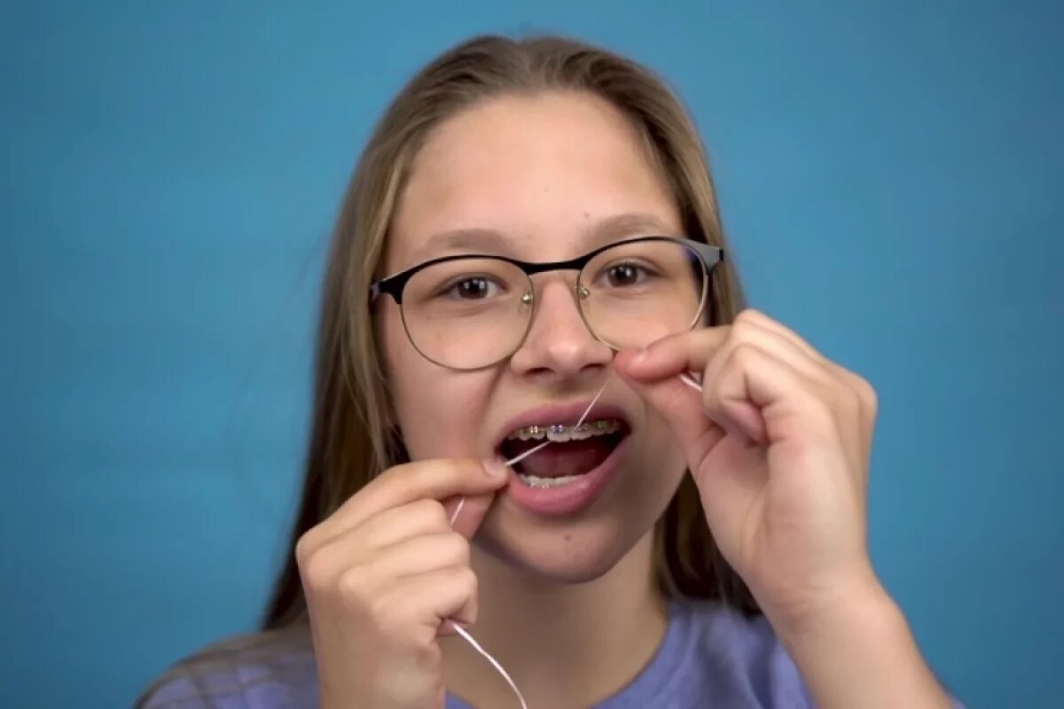    Зубы с брекетами придется чистить гораздо чаще двух раз в день, поэтому процесс лучше оптимизировать, чтобы он проходил качественно, легко и непринужденно.