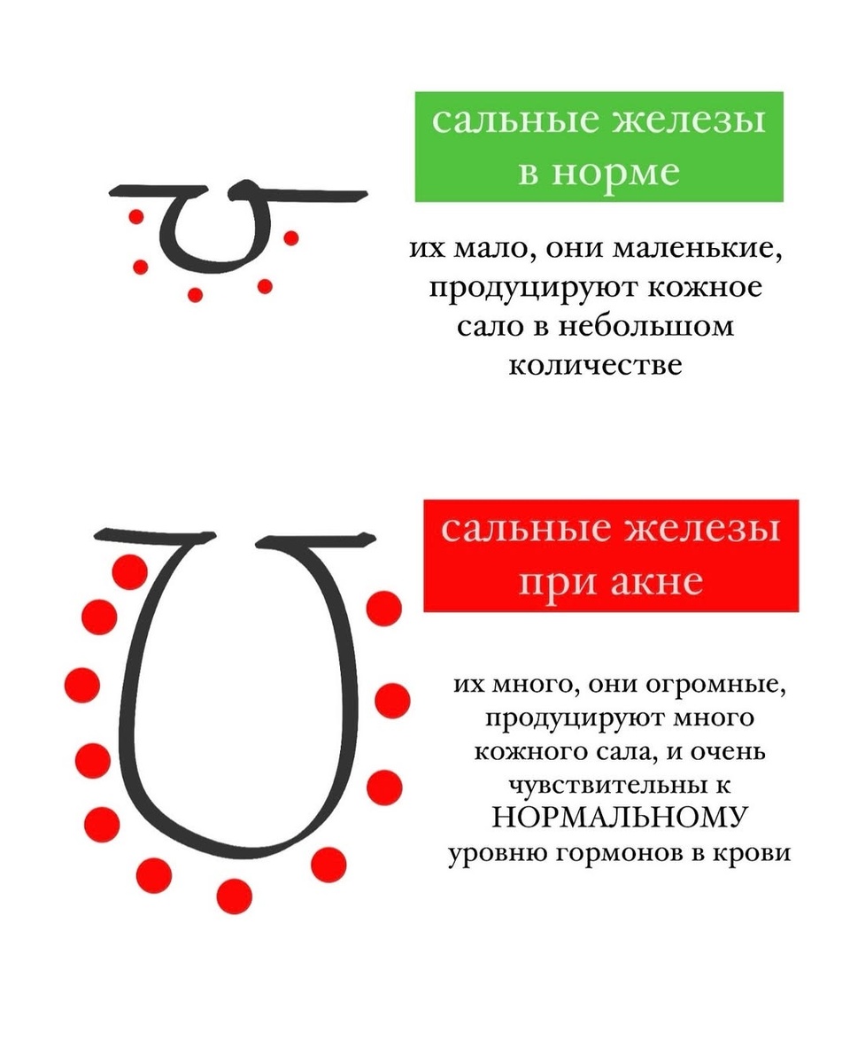 👉🏼сравнение сальных желез в норме и при акне
