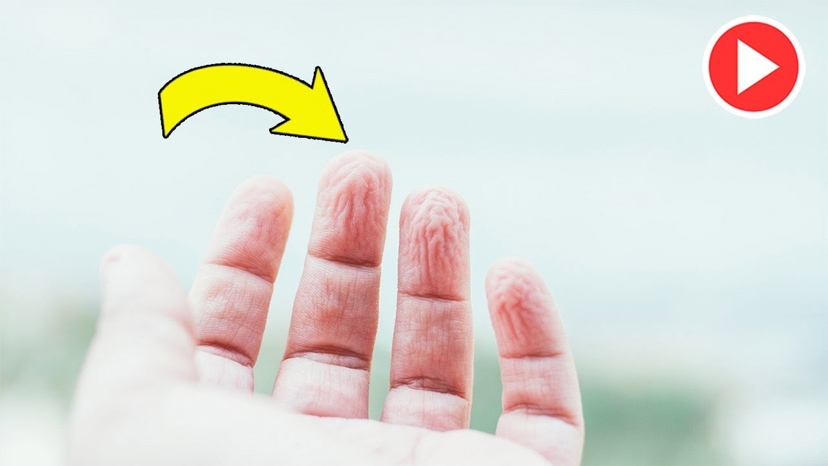 У неё покалывало в кончиках пальцев — диагноз поставили только через полгода