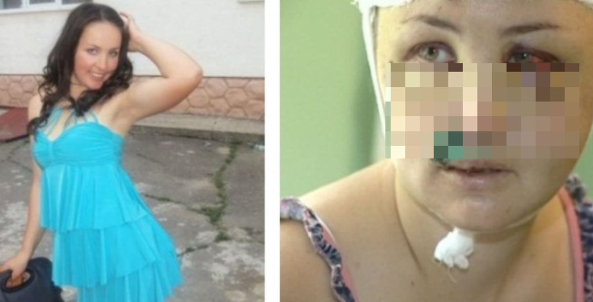 Фото Ирины до и после случившегося: соцсети, телевизионные кадры