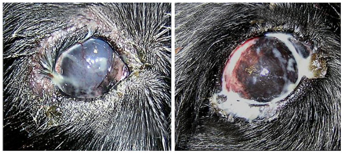 Рисунок 2. Классическая картина тяжелого сухого кератоконъюнктивита на момент начала лечения (фото Перепечаева К.А.)