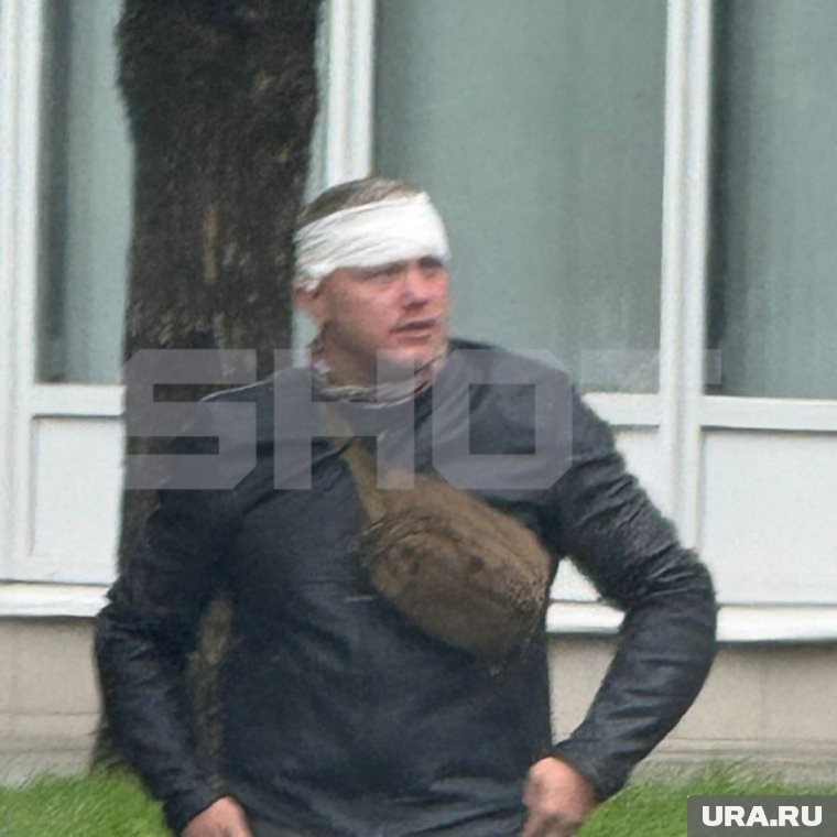 Блиновский обвинил водителя кроссовера, что тот пытался его сбить. Фото: telegram-канал SHOT