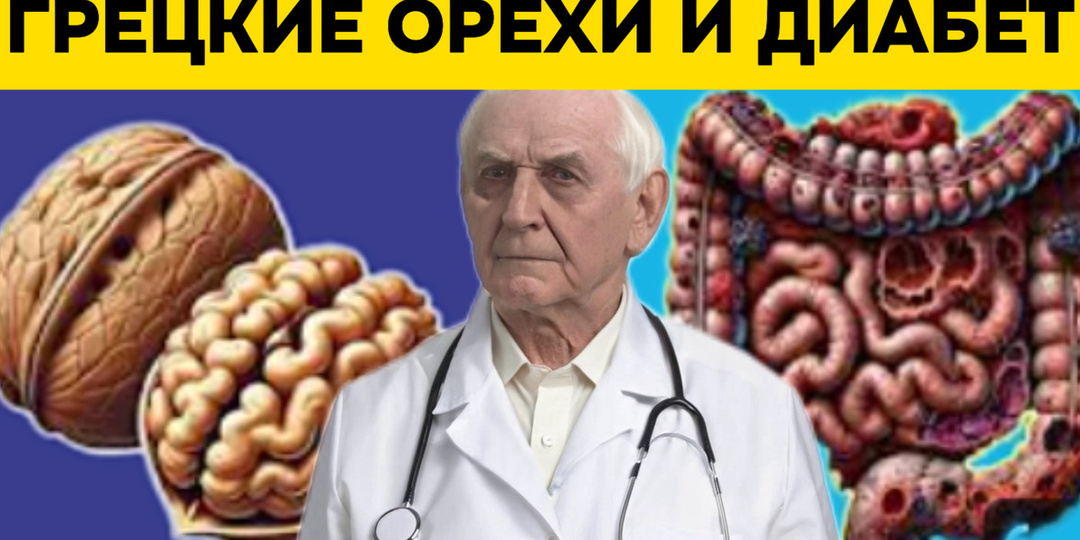 Диабет под контролем: что случится, если есть грецкие орехи каждый день в течение месяца