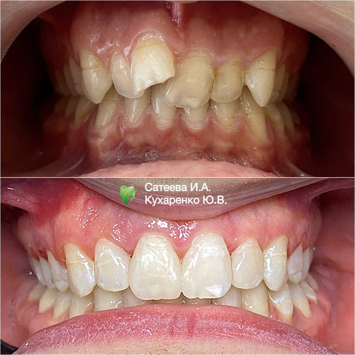 Когда смотришь на такие результаты лечения, может показаться, что это невозможно!