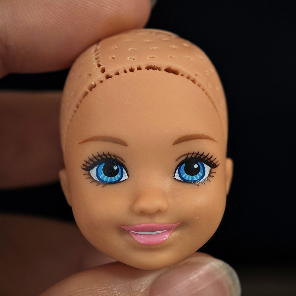 Двойные и тройные разрывы спереди на линии роста волос