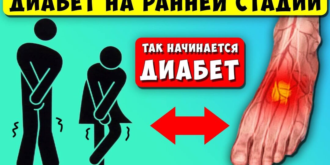 7 ранних симптомов диабета, которые видны на коже