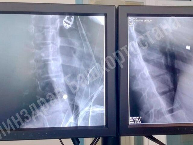    Фото: телеграм-канал "Айрат Рахматуллин"