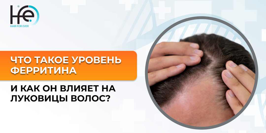 Что такое уровень ферритина и как он влияет на луковицы волос?