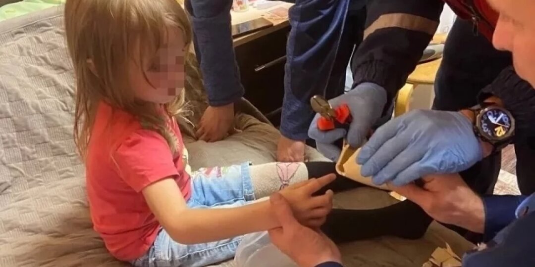 В Ижевске спасли 4-летнюю девочку, чей палец застрял в увлажнителе воздуха