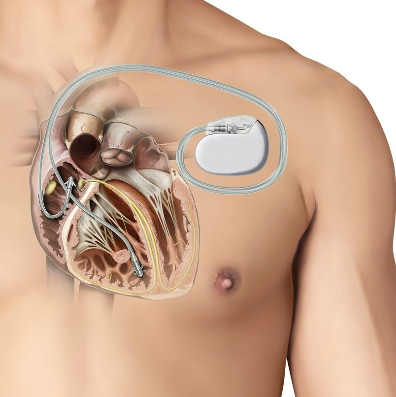 Взято из открытых источников