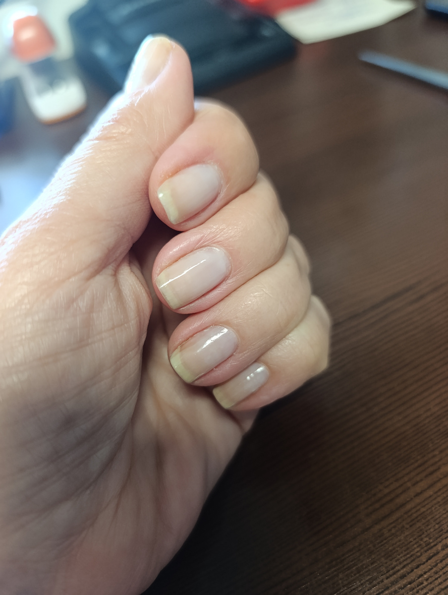 Свои ногти сейчас. 