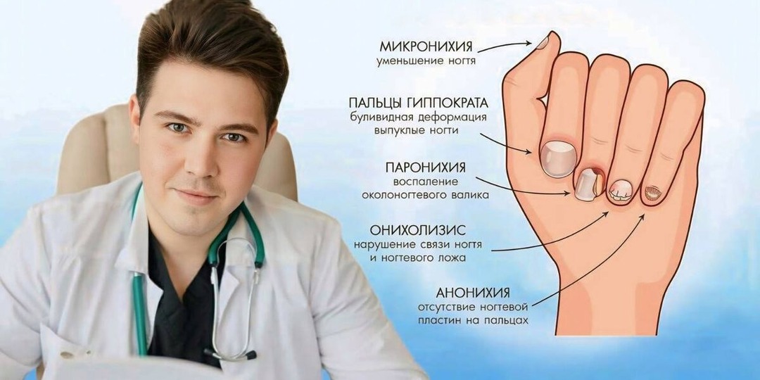 10 подсказок на кончиках пальцев: что ногти говорят о вашем здоровье