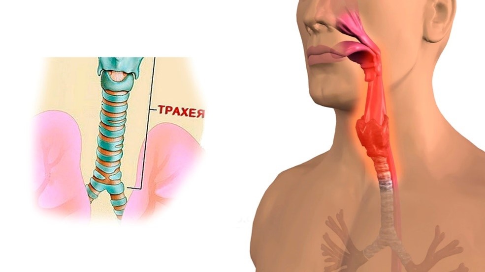 Фото с Яндекс картинки