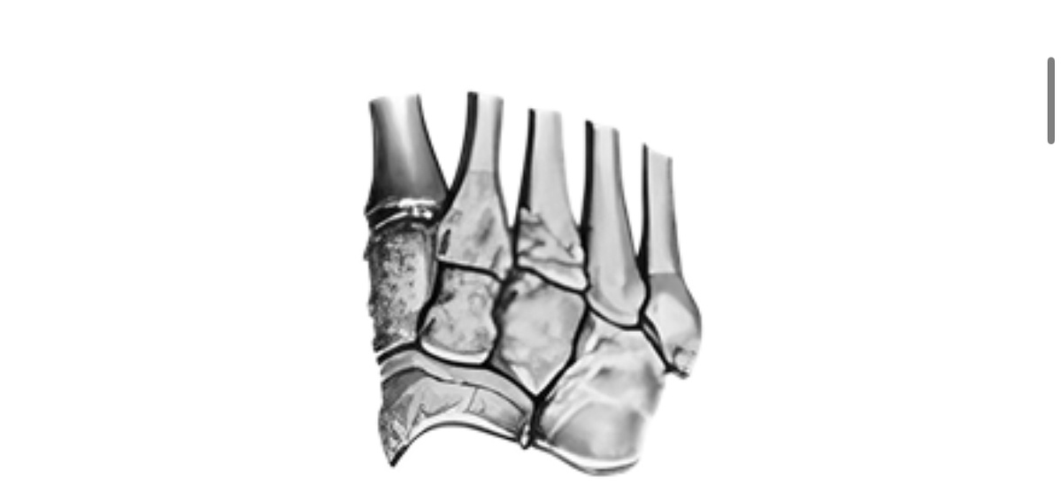 Короткие кости — кости из губчатого вещества, покрытого снаружи тонким слоем компактного вещества. Имеют множество мелких костномозговых полостей. Это кости запястья, предплюсны (задней части стопы).