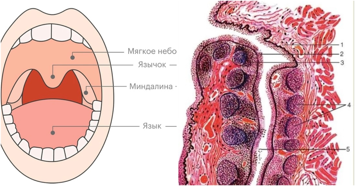 1) слизистая оболочка , 2)многослойный плоский эпителий ,3) лимфоидная ткань 4) лимфоидные узелки , 5) просвет крипты