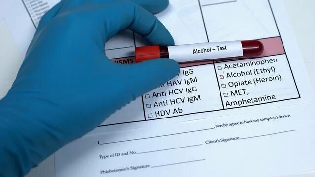 Фото заимствовано - https://stock.adobe.com/be_fr/search/images?k=Test&search_page=87