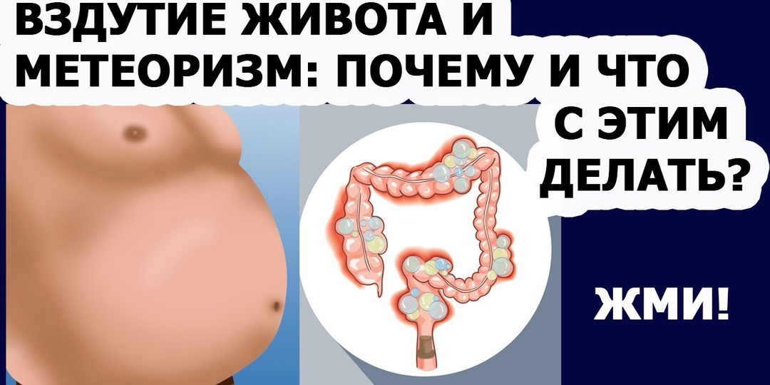 Вздутие живота может быть смертельно опасным