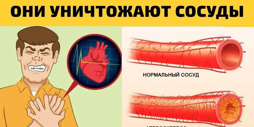 7 привычек, которые убивают сосуды