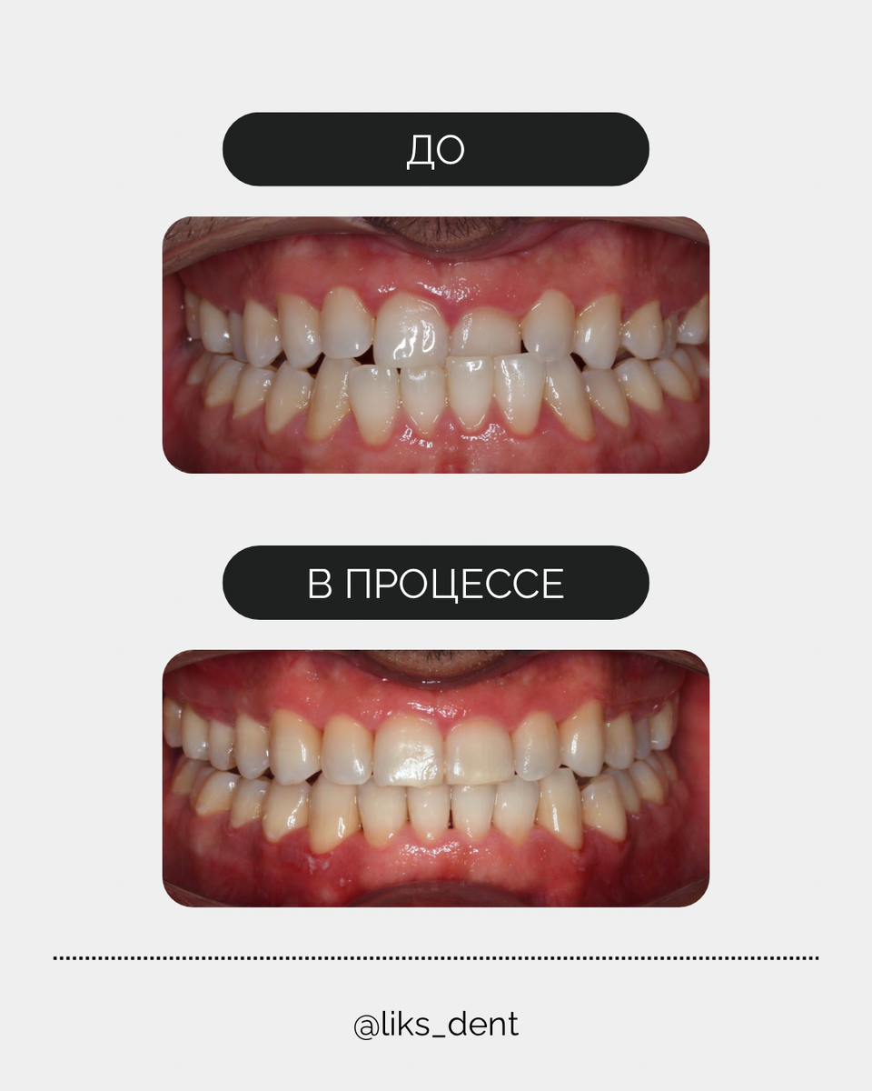 До/в процессе