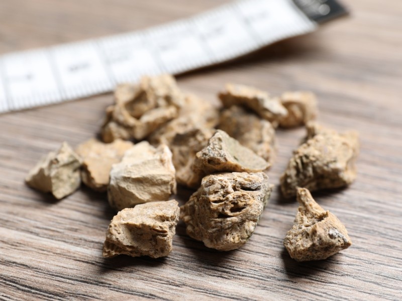    Магнитный микробот помогает растворять камни в почках