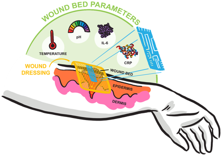 RMIT📷Визуальное представление того, как система гибких датчиков будет размещаться на руке