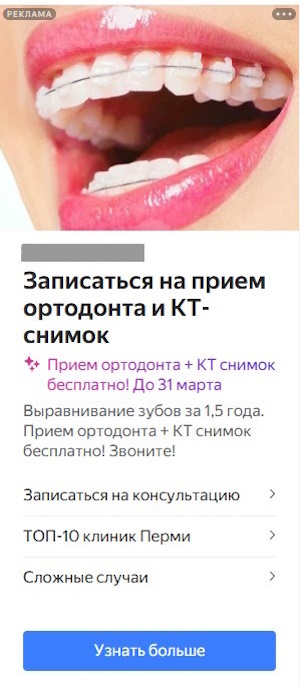 Примеры объявлений для рекламной кампании по брекетам в РСЯ в Яндекс.Директ