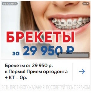 Примеры объявлений для рекламной кампании по брекетам в РСЯ в Яндекс.Директ