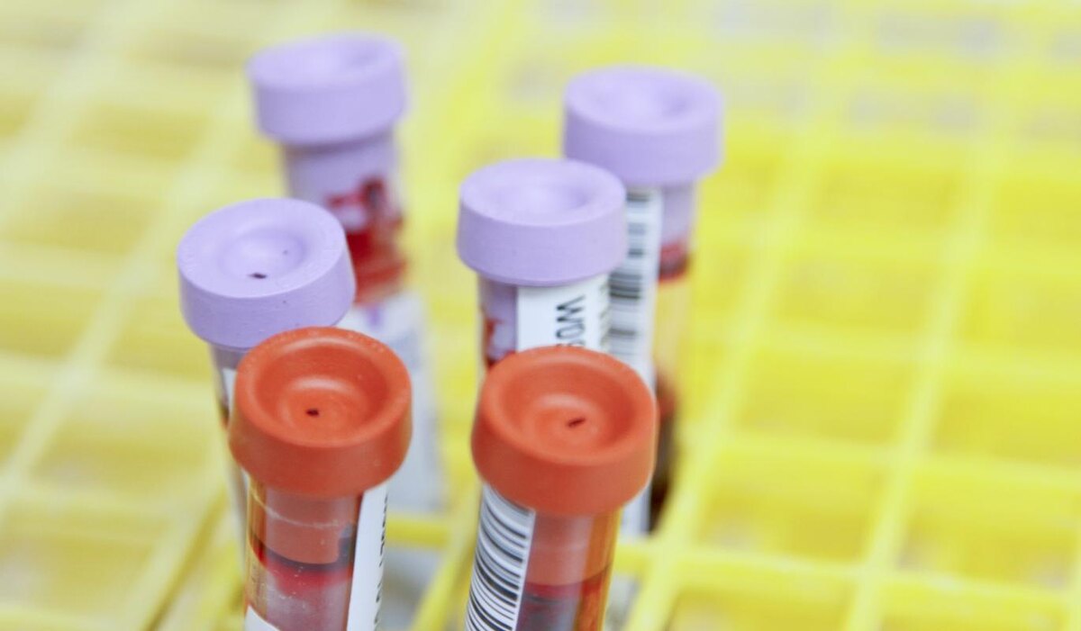     В каких случаях нужно сдать генетический тест