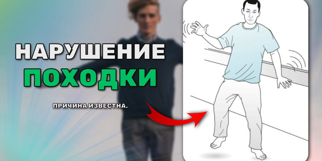 Болевой в поясничной области и бедре, которая распространяется по задней поверхности бедра и в ногу.