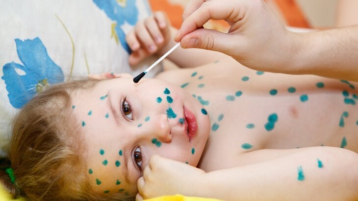 Фото: 123RF/antikainen