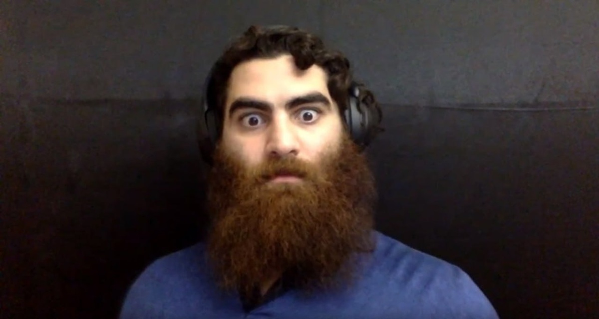 Испепеляющий взглядом гномик, гармонично равный по длине и ширине. Такое вот солнышко)))