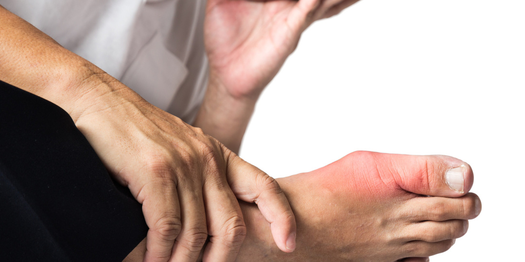 Как вывести мочевую кислоту из организма: эффективные методы, диета и профилактика