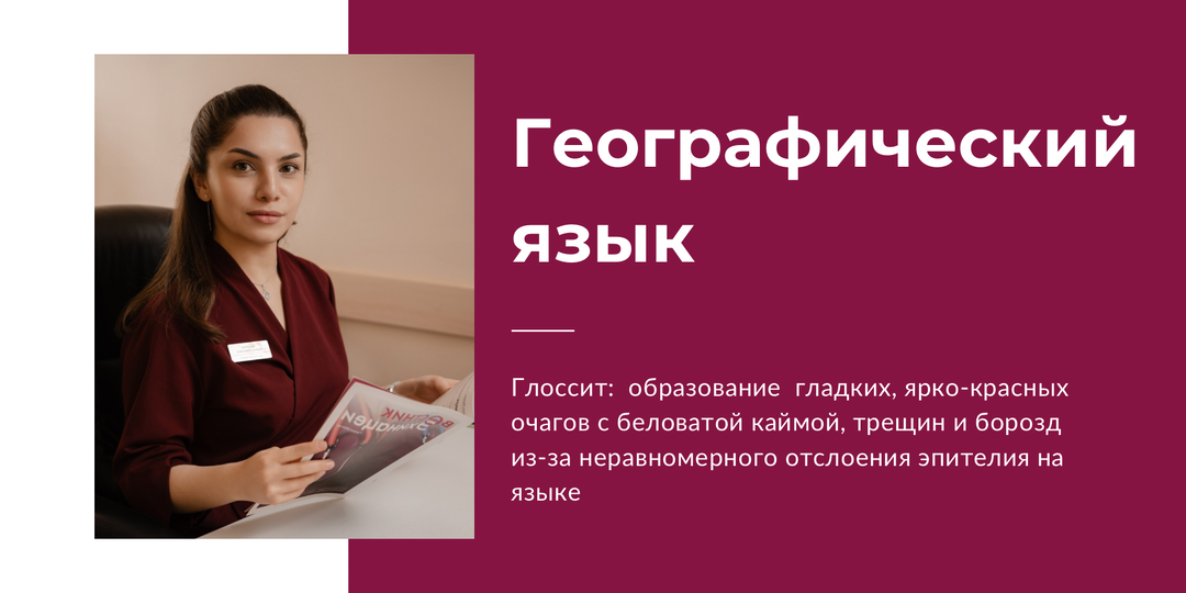 Пятна на языке