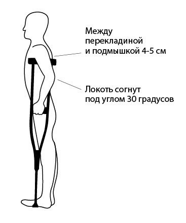 Иллюстрация: Правильное положение костыля. Обратите внимание на зазор под подмышкой и угол сгиба локтя.