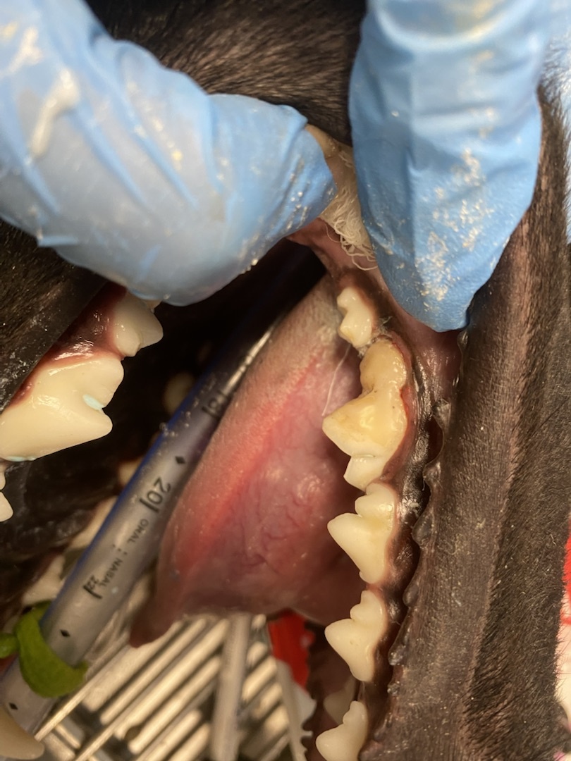 После установки реставрации