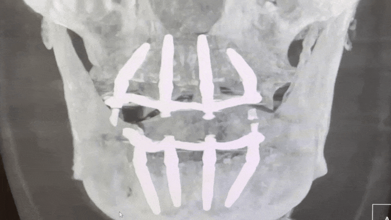 Визуализация КЛКТ