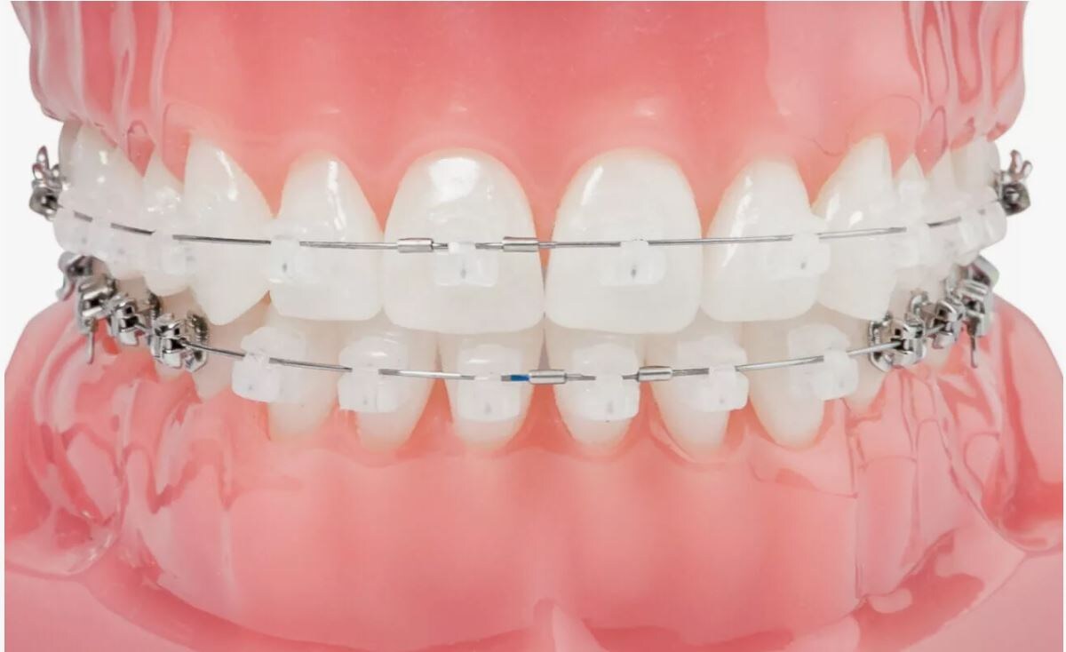 Стоматология Премоляр