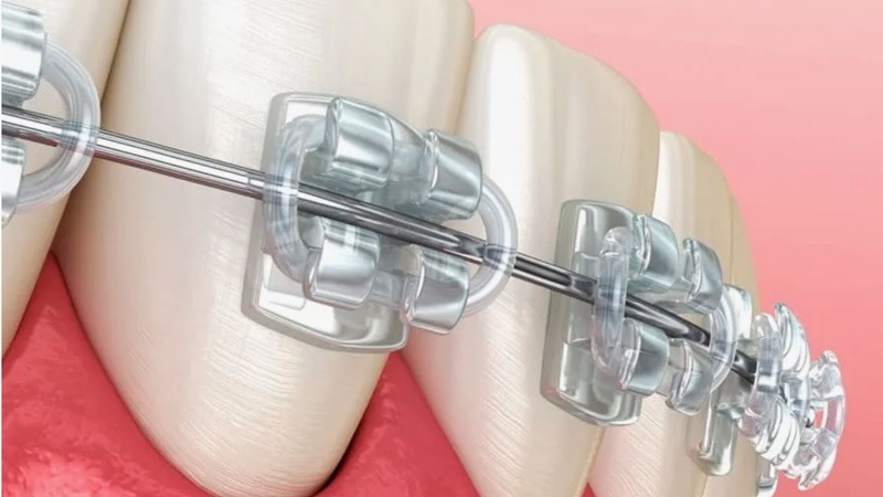 Стоматология Премоляр