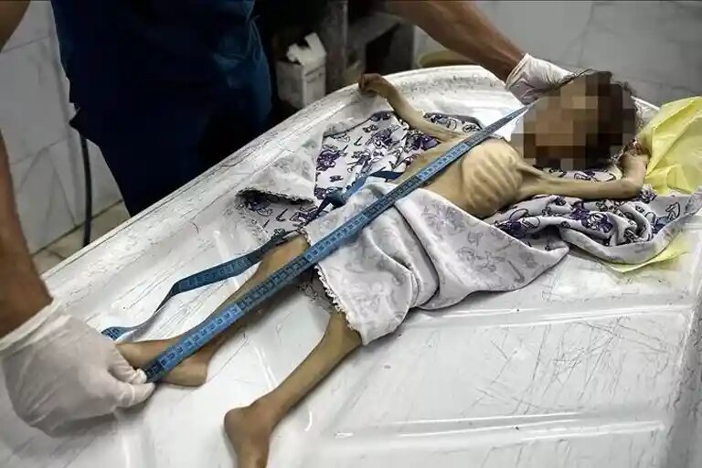    Источник: aa.com.tr