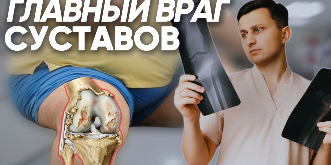 Как лишний вес убивает Ваши суставы и почему нужно худеть как можно раньше